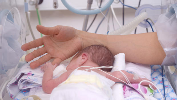 Honvéd Hospital’s Neonatal Intensive Care Unit to Close Only Temporarily post's picture