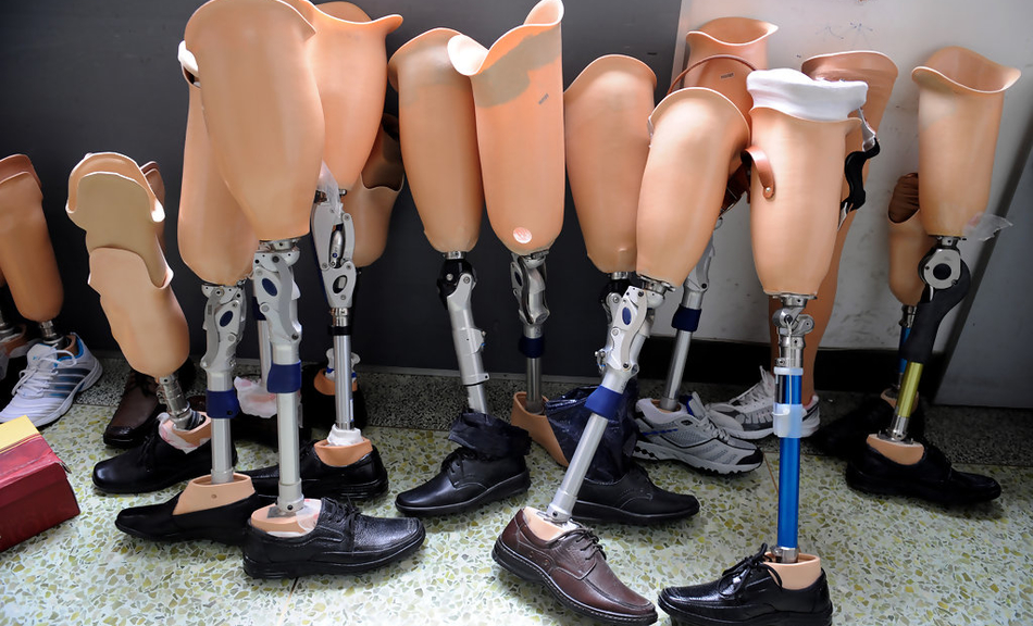  Prosthetics and Orthotics Industry 