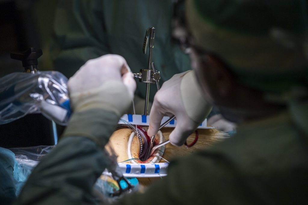 Coronavirus: Hungary Hospitals to Resume Elective Surgeries post's picture