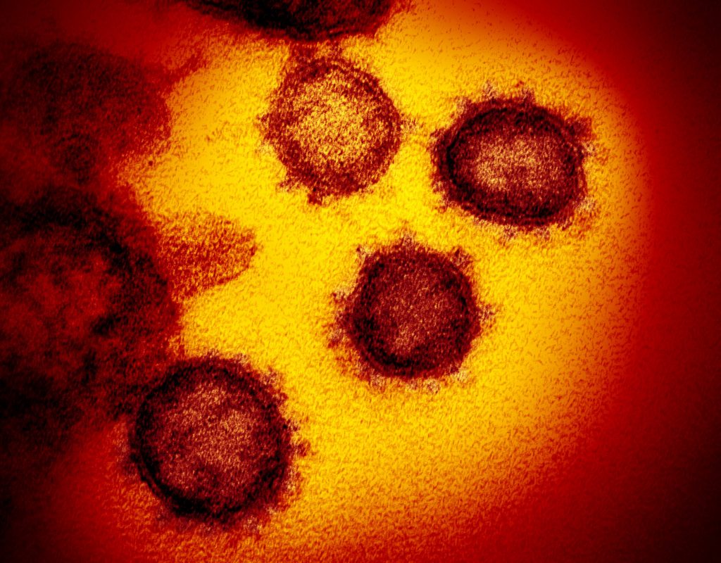 Coronavirus Appears in Hungary’s Third Neighboring Country post's picture