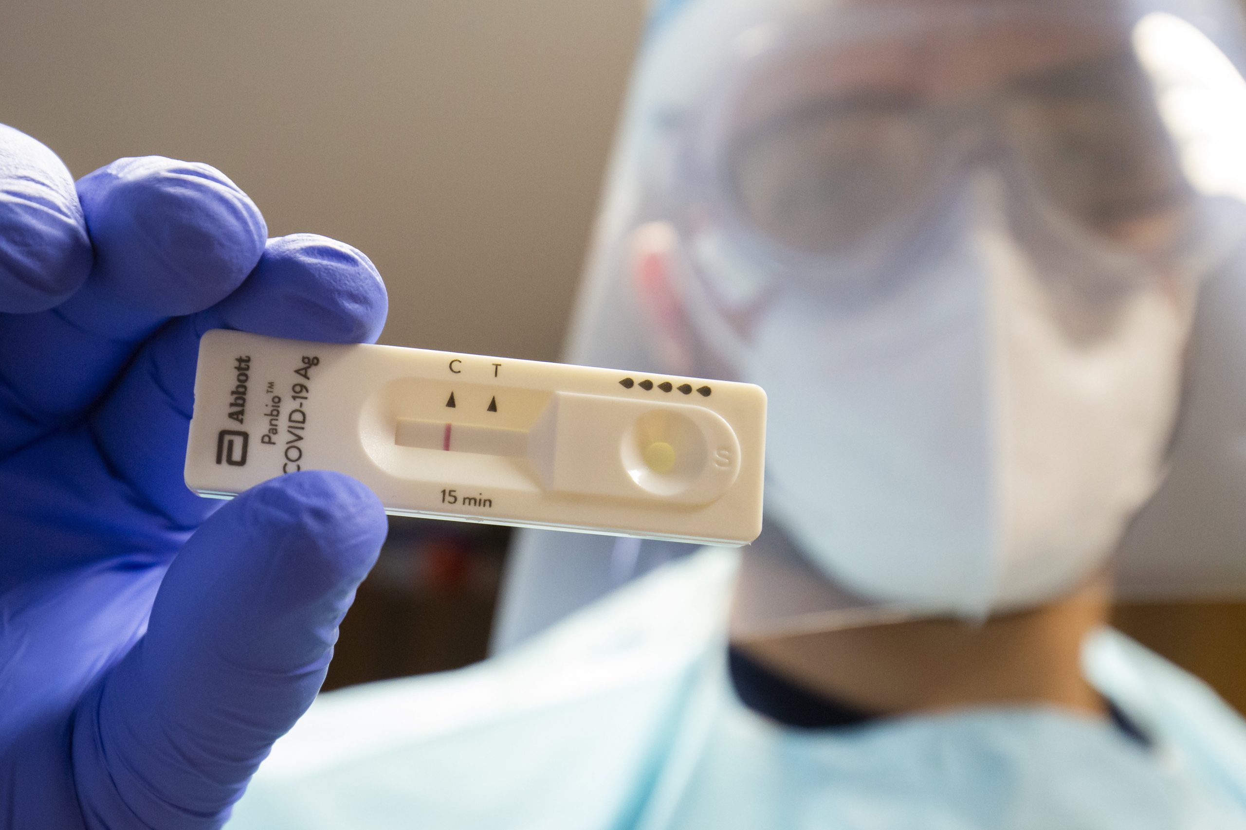 Hungarian Researchers: Covid-19 Pneumonia Caused by Virus from Patient's Upper Respiratory Tract
