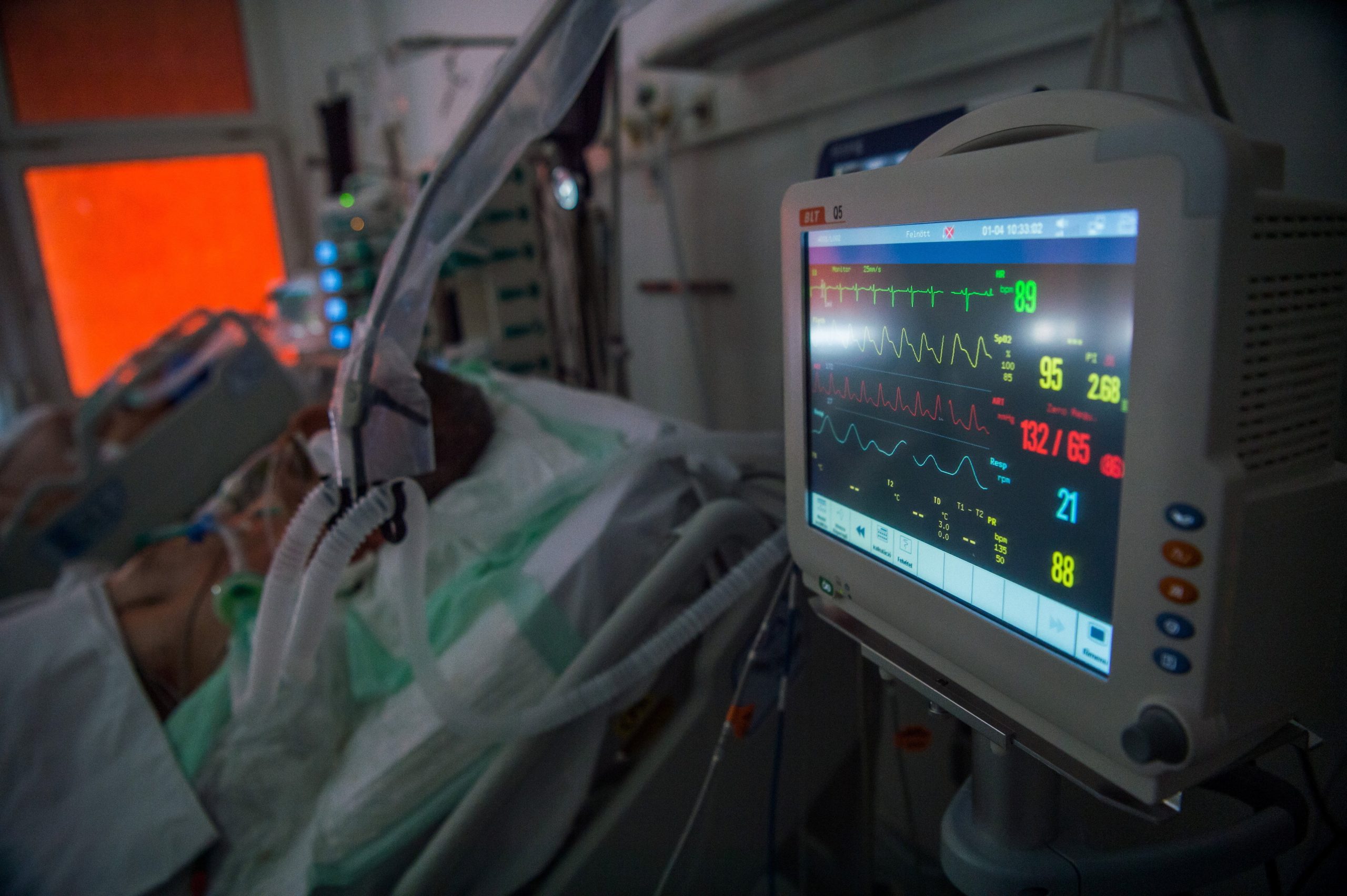 Hungary's Ventilator Death Rate 'Only' Around 80 Percent, Healthcare Center Says