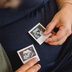 Hungarian NGOs Support Newly Introduced Heartbeat Regulation regarding Abortion