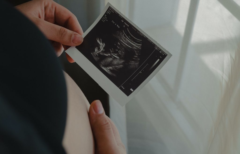 New Rule: Women Should Listen to Fetal Heartbeat before Abortion post's picture