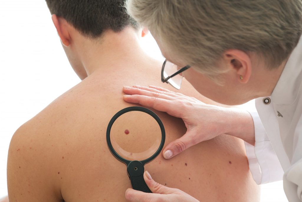 Number of Skin Cancer Cases Rising Rapidly post's picture