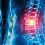 University of Szeged Leads in mRNA-Based Spinal Injury Treatment