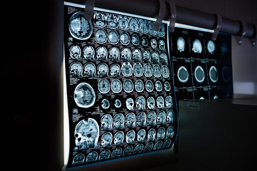 Semmelweis University’s Stroke Care Program Receives Recognition post's picture