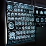 Semmelweis University’s Stroke Care Program Receives Recognition