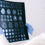 AI Helps Decode How Unexpected Events Shape Our Memory
